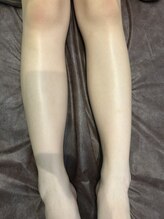 レイモード(Ray mode)/小学生脱毛