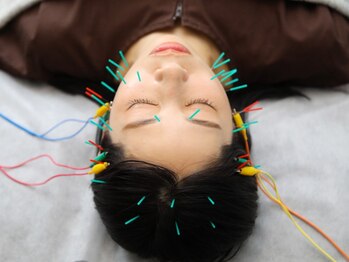 美容鍼灸サロン ユールーム(YOUROOM)の写真/【美容鍼×ララピール】芸能人モデル話題の美容鍼&ララピールでお顔の悩み徹底改善♪《肩こり/腰痛にも》