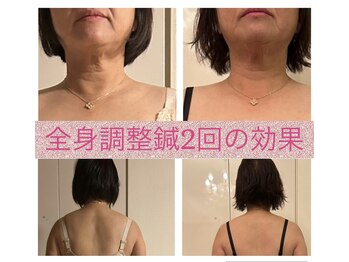 フェルーシュ鍼灸 銀座(Feruche)