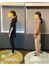 灯(akari)/猫背改善！お客様変化☆30代女性