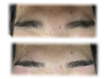 メンズブリリアンス/左右のバランスがとれない方も◎