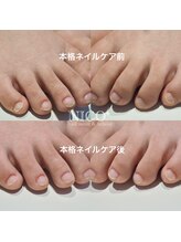 ニコプラス(NICO+)/足のお手入れできていますか？