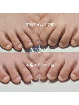 ニコプラス(NICO+)/足のお手入れできていますか?