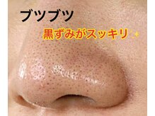 パウザ(PAUSA)/お悩みに合わせたオプション◎