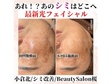 桜の雰囲気（本当に結果が出る最新・最高級マシーンのみを使用しています♪）