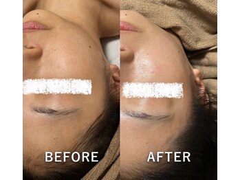 リュミエール(Lumiere)/むくみが取れて一気に小顔に！