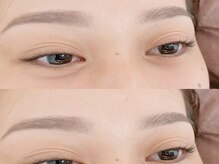 ナポーラ(NAPORA)