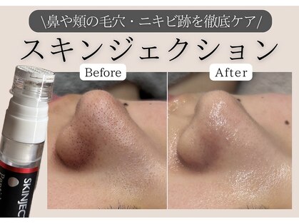エミエル(EMIER)の写真