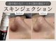 エミエル(EMIER)の写真