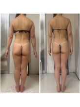 セルビューティー(Cell Beauty)/50代、全身綺麗に痩せました