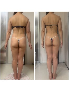 セルビューティー(Cell Beauty)/50代、全身綺麗に痩せました