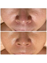 ボディメイキング キキ(Bodymaking KIKI)/ほうれい線・シワ改善◎