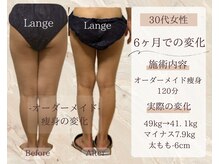 サロン ド ボーテ ラーンジュ 岐阜店(salon de beaut'e L'ange)/ハイパ-ナイフEX2ダイエット痩身