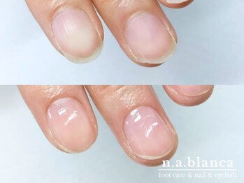 エヌエーブランカ 東白楽店(n.a.blanca)の写真/全メニューケア付き◎優しく丁寧な甘皮ケアで健康的な美しい爪へ♪モチも格段にUP◎ネイルケアのみも大歓迎