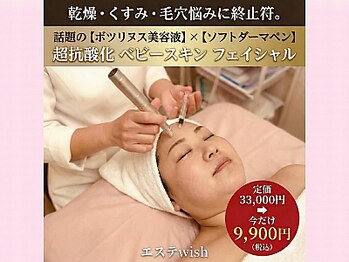 ウィッシュ(WISH)