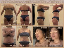 ボディリカバリー(Bodyリカバリー)