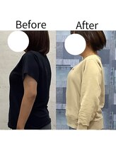 リセラ(Re:seraph)/Before After