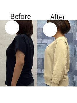 リセラ(Re:seraph)/Before After