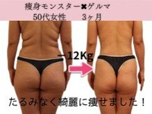 ファニービー 茨木本店/Before→After