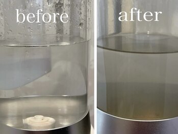シロ(siro)の写真/【岡山初導入☆ハイドロマシン】高濃度水素水で黒ずみ毛穴を改善、毛穴レスで艶肌美人に◎お化粧ノリもUP!!