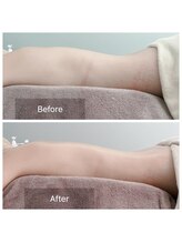 ジュ ベル(je.belle)/リンパケアのビフォーアフター