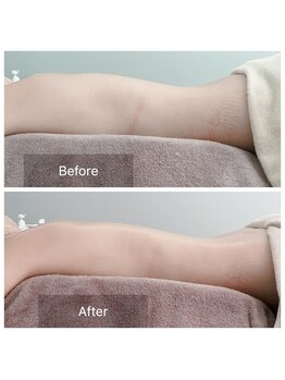 ジュ ベル(je.belle)/リンパケアのビフォーアフター