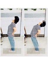 門前仲町イエティ鍼灸整骨院（旧：イエティ鍼灸整骨院）/ビフォーアフター♪