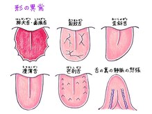 風香る鍼灸院/舌を見て、体質を見抜きます！