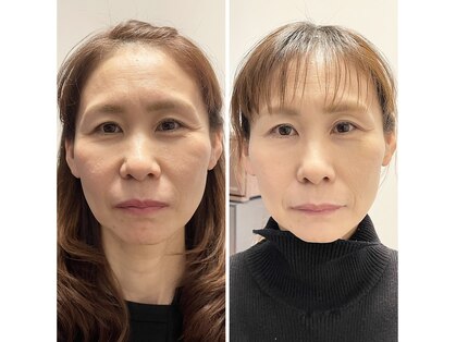 リサ鍼灸院(RISA鍼灸院)の写真