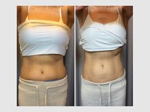 カロン 銀座(Kalon)/【腸もみ60分コース】10回結果！