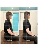 鍼灸ハリカラ/３０代前半のbefore/after