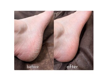 コフズ(Kofz)/ひび割れ前にケアしましょ！