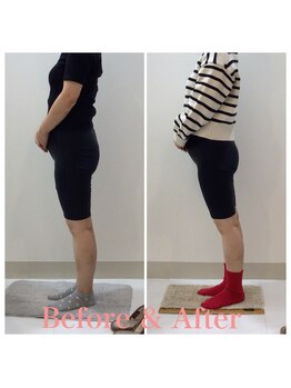 スタイルラボ高松/産後の骨盤矯正の効果♪