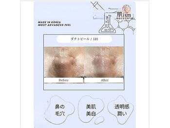 肌イズム つくば店(肌ism)/ダクトピールで「毛穴レス肌」に