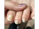 アクア ド エンジェル(アクア de エンジェル)の写真/巻き爪・深爪矯正ならお任せ♪25年のベテランが施術するスクール運営のサロンで、爪の悩みをケアして◎