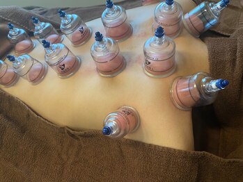 灯香庵 玉響(たまゆら)/【背中】カッピング