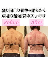 アユスリム(AYU SLIM)/短期集中ケア　充実痩身♪