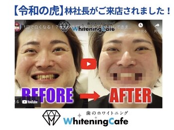 ホワイトニングカフェ 岡崎店(WhiteningCafe)/★ホワイトニングカフェ岡崎店★