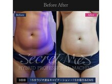 エキュレ ジャーニー トゥ マイ トータル ビューティー(equrer)/フェイシャルケア