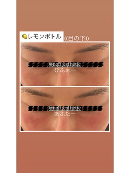 ノフ 恵比寿(noff)/レモンボトル