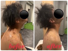 モアルポ 四日市(more repos)/初回お客様befor＆after