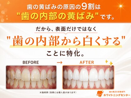 ホワイトニングセンター 広島福山駅前店の写真