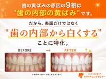 ホワイトニングセンター 広島福山駅前店