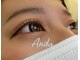 アンディ(Andy)の写真