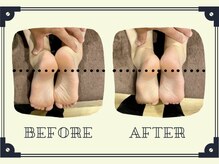 整体院プリュ/Before→ After［17］