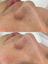 洗顔サロン 池袋(SENGAN)/手触りなめらかに