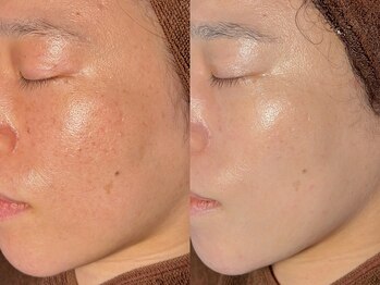 ルーナジェーナ(Luna llena)/池袋　エステ　ルーナジェーナ