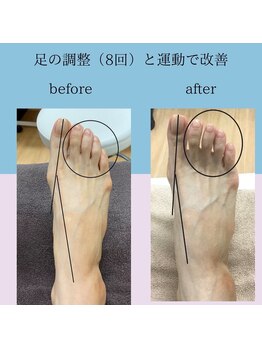 さいわい整骨院/足の悩み