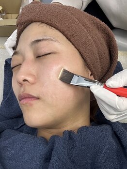 ハリツヤをUPしたい