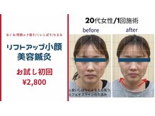 れんげ鍼灸整骨院